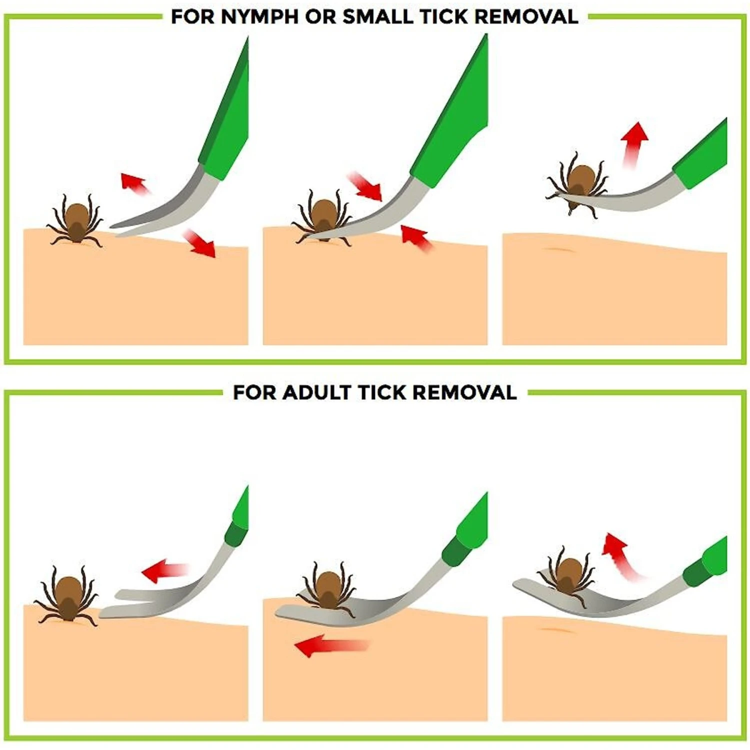 TickCheck Premium Dog Tick Removal Kit 5 TickCheck Premium Dog Tick Removal Kit - Image 3