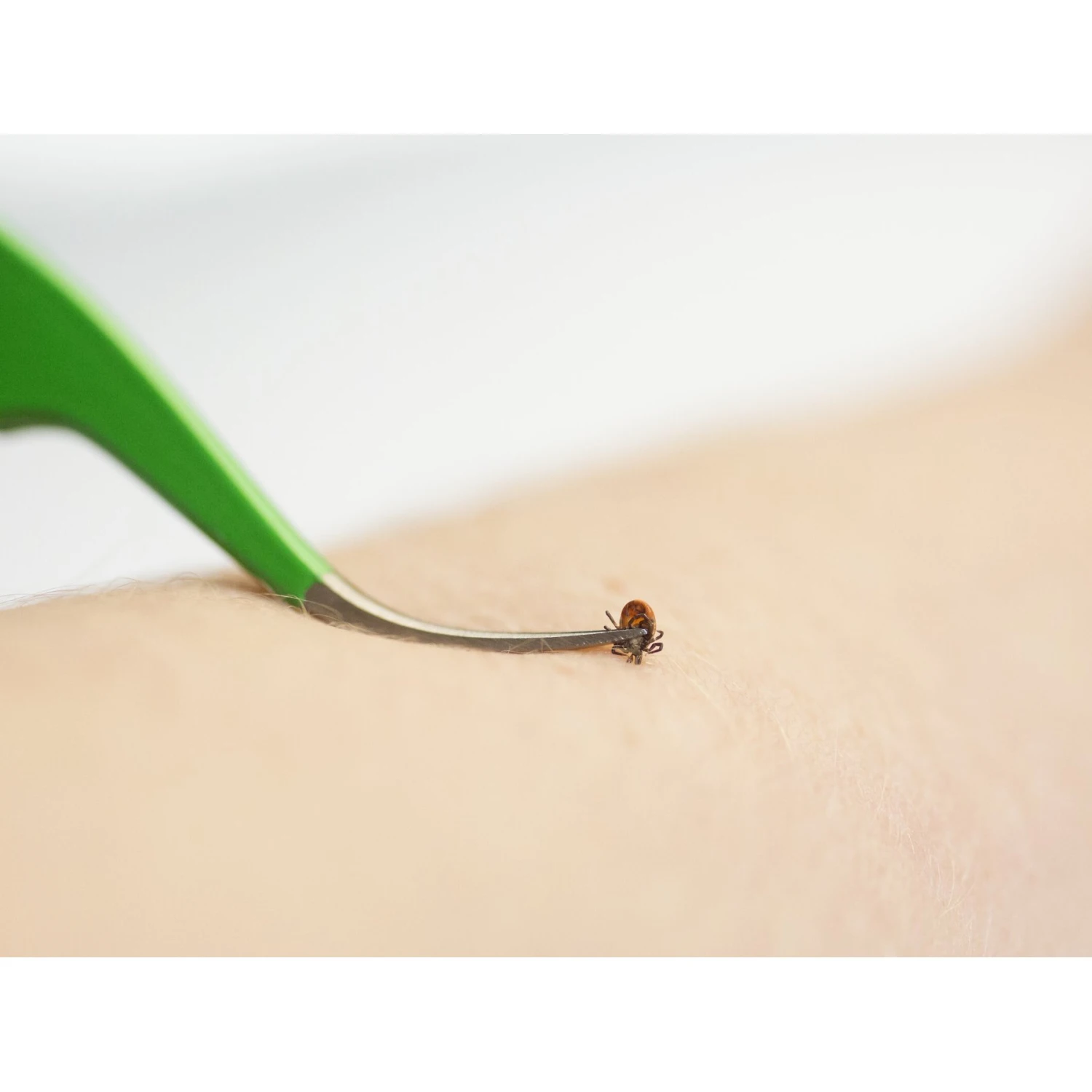 TickCheck Premium Dog Tick Removal Kit 6 TickCheck Premium Dog Tick Removal Kit - Image 4